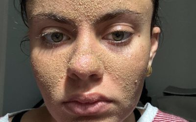 Her ‘Caveman’ Skin Care Routine Has Skeptics, but She Says It’s Real