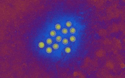 What to Know About the Hepatitis A Outbreak in L.A. County